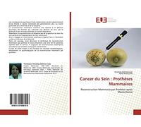 Cancer du Sein : Prothèses Mammaires: Reconstruction Mammaire par Prothèse après Mastectomie