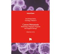 Cancer Metastasis - Mechanism, Diagnosis, Prognosis and Targeted Therapy