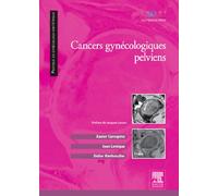 Cancers gynécologiques pelviens