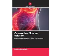 Cancro do cólon em oclusão: Aspectos epidemiológicos, clínicos e terapêuticos