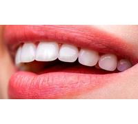 Cap Adrénaline Blanchiment dentaire à Saint-Lazare Paris 9ème