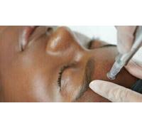 Cap Adrénaline Massage Kobido à Paris 16