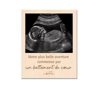 Capaneus Annonce Grossesse Cadre Photo, Cadre Photo Echographie, Notre plus belle aventure commence par un battement de cœur, Cadeau Grossesse pour Nouvelle Maman