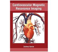 Cardiovascular Magnetic Resonance Imaging