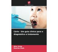 Cárie - Um guia clínico para o diagnóstico e tratamento