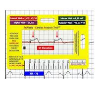 Cartes de référence | Carte de référence portable | Règle portable Fournitures Outil de mesure pour hôpital médecine clinique