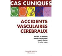 Cas Cliniques : Accidents Vasculaires Cérébraux - Formes Cliniques Habituelles Et Inhabituelles