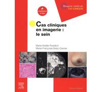 Cas cliniques en imagerie : le sein