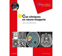 Cas cliniques en neuro-imagerie: Pathologies tumorales