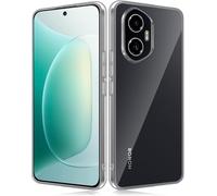 Case Compatible With Honor 300 Case, Ultra Thin Transparent Four Corners Anti-Fall Soft Tpu Shockproof Bumper Protective Cover For Honor 300