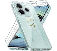 Case Compatible With Xiaomi Redmi Note 14 5g (Not For 4g), 3-Piece Tempered Glass Screen Protector, Soft And Transparent Case, Anti-Fingerprint And Glitter Case