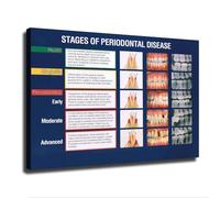 CBQZCHWDKT Professional Periodontics Poster - Illustrating the Stages from Gingivitis to Advanced Periodontitis, for Medical Reference(Framed,12x18inch(30x45cm))