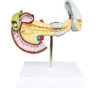 CCKUYT Modèle corporel Modèle éducatif Modèle Anatomique d'organe Humain - Modèle de pancréas - Modèle pathologique duodénal pancréatique - Modèle Anatomique d'organe Gastro-intestinal - pour l'étude
