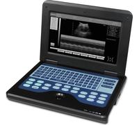 CE Échographe portable Échographie B avec sondes convexes et linéaires CMS600P2 Scanner à ultrasons