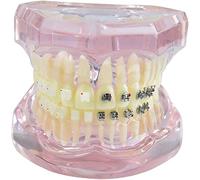 CEEBUS Modèle de démonstration d'orthodontie Dentaire, Modèle de Traitement orthodontique des Dents avec Brackets métalliques autoligaturants Modèle explicatif