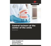 Central incisors at the center of the smile: Bimemitism