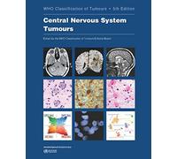Central Nervous System Tumours