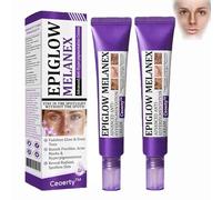 Ceoerty Epiglow Melanex Advanced Anti-Hyperpigmentation Cream,Dark Spot Cream,Anti Hyperpigmentation Face Cream,Anti Aging Face Cream,Dark Spot Remover for Face and Body,for All Type Skin (2)