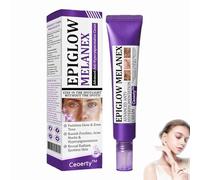 Ceoerty Epiglow Melanex Advanced Anti-Hyperpigmentation Cream,Dark Spot Cream,Anti Hyperpigmentation Face Cream,Anti Aging Face Cream,Dark Spot Remover for Face and Body,for All Type Skin (1)