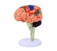 Cerveau Démontable avec Socle Didactique