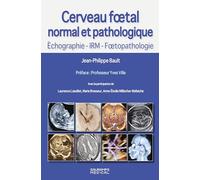 Cerveau foetal normal et pathologique -Echographie, IRM, Foetopathologie