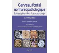 Cerveau Foetal Normal Et Pathologique - Echographie, Irm, Foetopathologie