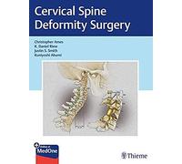 Cervical Spine Deformity Surgery