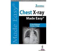 Chest X-Ray Made Easy