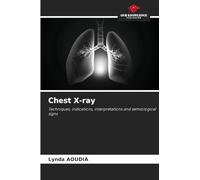 Chest X-ray: Techniques, indications, interpretations and semiological signs