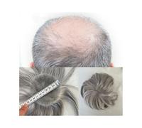 Cheveux Postiche for homme avec zone chauve, 8 x 8 cm, base fine en PU, postiche for homme, 15 cm, système de remplacement de cheveux humains Perruques quotidiennes