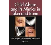 Child Abuse And Its Mimics In Skin And Bone