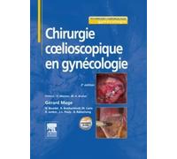 Chirurgie coelioscopique en gynécologie