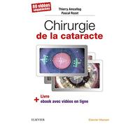 Chirurgie de la cataracte: 60 Videos Sequencees