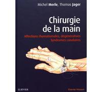 Chirurgie de la main: Affections rhumatismales, dégénératives. Syndromes canalaires