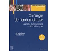 Chirurgie de l'endométriose: Approche multidisciplinaire médico-chirurgicale