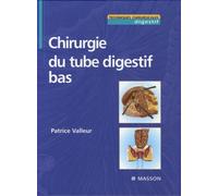 Chirurgie du tube digestif bas
