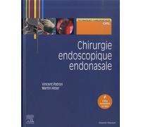 Chirurgie endoscopique endonasale