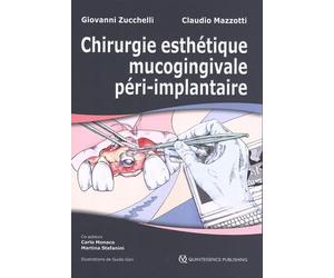 Chirurgie esthétique mucogingivale péri-implantaire: 2 volumes