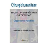 CHIRURGIE HUMANITAIRE. SEQUELLES DE BRULURES CHEZ L ENFANT: SUGESSIONS D INDICATIONS