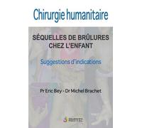 Chirurgie Humanitaire - Séquelles De Brûlures Chez L'enfant - Suggestions D'indications