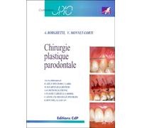 Chirurgie plastique parodontale