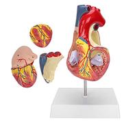 Chiyyak Modèle D'organe Cardiaque de Simulation avec Paroi Ventriculaire Démontable pour L'éducation Médicale 6,7 X 5,1 X 11,0 Pouces