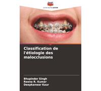 Classification de l'étiologie des malocclusions