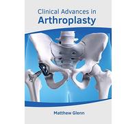 Clinical Advances In Arthroplasty