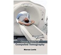 Clinical Aspects Of Computed Tomography