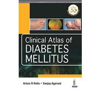 Clinical Atlas Of Diabetes Mellitus