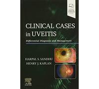 Clinical Cases in Uveitis: Differential Diagnosis and Management