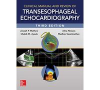 Clinical Manual and Review of Transesophageal Echocardiography
