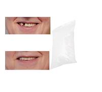 Clip dans les dents des placages, perles de réparation de dents temporaires pour manquer les dents cassées dentaire dentaire matériau de dent dentaire, ciment dentaire (100g)