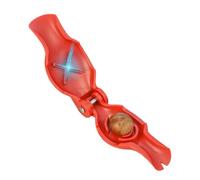 Clip pour châtaignes en noyer - Clip casse-noix - Ouvre-écrous manuel et outils de découpe - Clip casse-noix en acier inoxydable pour noix, châtaignes, châtaignes